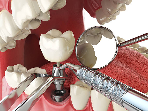 Emergency Dental Care for Trauma or Injury